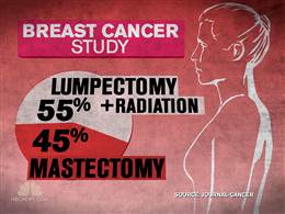 LumpectomyVsMastectomy (11K)